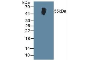 Detection of ALT in Human Serum using Polyclonal Antibody to Alanine Aminotransferase (ALT) (ALT 抗体  (AA 367-480))