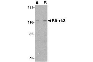 Image no. 1 for anti-SLIT and NTRK-Like Family, Member 3 (SLITRK3) (C-Term) antibody (ABIN1493367) (SLITRK3 抗体  (C-Term))