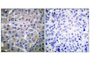 Immunohistochemistry (IHC) image for anti-Breast Cancer Anti-Estrogen Resistance 1 (BCAR1) (Tyr410) antibody (ABIN1847916) (BCAR1 抗体  (Tyr410))