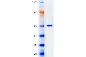 Western Blotting (WB) image for Perilipin 1 (PLIN1) (Transcript Variant 1) protein (Myc-DYKDDDDK Tag) (ABIN2728664)