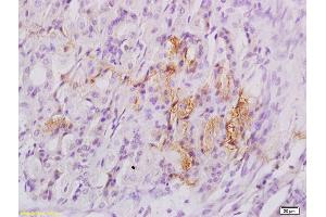 Immunohistochemistry (IHC) image for anti-Eukaryotic Translation Initiation Factor 4E Binding Protein 1 (EIF4EBP1) (pThr37), (pThr46) antibody (ABIN682978)