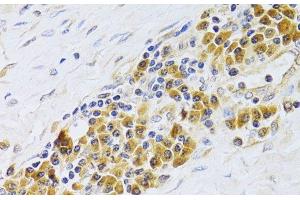 Immunohistochemistry of paraffin-embedded Human esophagus using PA2G4 Polyclonal Antibody at dilution of 1:100 (40x lens). (PA2G4 抗体)