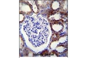 CASP3 Antibody (C-term) (ABIN655271 and ABIN2844863) immunohistochemistry analysis in formalin fixed and paraffin embedded human kidney tissue followed by peroxidase conjugation of the secondary antibody and DAB staining. (Caspase 3 抗体  (C-Term))