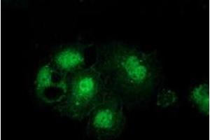 Anti-GSS mouse monoclonal antibody (ABIN2453904) immunofluorescent staining of COS7 cells transiently transfected by pCMV6-ENTRY GSS (RC203174). (Glutathione Synthetase 抗体)