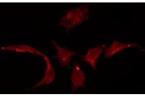ABIN6275333 staining HuvEc by IF/ICC. (SLC22A3 抗体  (Internal Region))