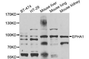 Western blot analysis of extracts of various cell lines, using EPHA1 antibody. (EPHA1 抗体)
