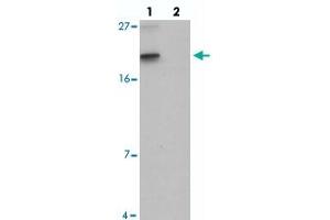 Western blot analysis of SPINK2 in mouse heart tissue with SPINK2 polyclonal antibody  at 1 ug/mL in (lane 1) the absence and (lane 2) the presence of blocking peptide. (SPINK2 抗体  (C-Term))