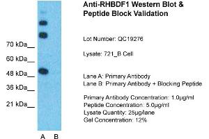Host:  Rabbit  Target Name:  RHBDF1  Sample Type:  721_B Whole Cell  Lane A:  Primary Antibody  Lane B:  Primary Antibody + Blocking Peptide  Primary Antibody Concentration:  1ug/ml  Peptide Concentration:  5ug/ml  Lysate Quantity:  25ug/lane/Lane  Gel Concentration:  0. (RHBDF1 抗体  (N-Term))