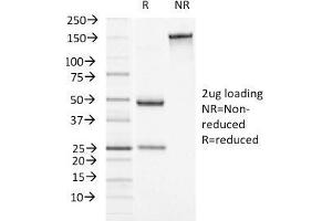 SDS-PAGE Analysis Purified Alpha-1-Antichymotrypsin Monoclonal Antibody (AACT/1451)Confirmation of Integrity and Purity of Antibody. (SERPINA3 抗体  (AA 49-187))