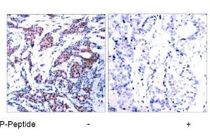 Image no. 1 for anti-Jun Proto-Oncogene (JUN) (pSer73) antibody (ABIN196613) (C-JUN 抗体  (pSer73))
