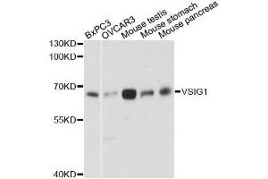 Western blot analysis of extracts of various cell lines, using VSIG1 antibody. (VSIG1 抗体  (AA 50-230))