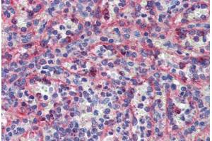 Spleen, Human: Formalin-Fixed, Paraffin-Embedded (FFPE) (KIF20A 抗体  (C-Term))