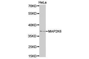 Western Blotting (WB) image for anti-Mitogen-Activated Protein Kinase Kinase 6 (MAP2K6) antibody (ABIN1873609)