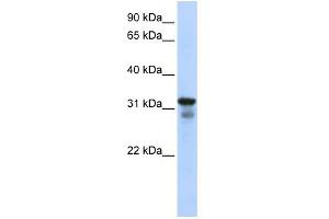 WB Suggested Anti-LAPTM4B Antibody Titration:  0. (LAPTM4B 抗体  (Middle Region))