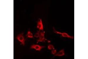 ABIN6274982 staining Hela cells by IF/ICC.