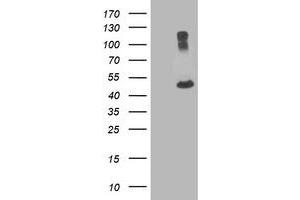 Western Blotting (WB) image for anti-Tubulin, alpha 8 (TUBA8) antibody (ABIN1501562) (TUBA8 抗体)