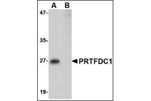 Western blot analysis of PRTFDC1 in human brain tissue lysate with this product at 1 μg/ml in the (A) absence and (B) presence of blocking peptide. (PRTFDC1 抗体  (Center))