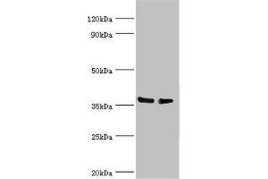 Western blot All lanes: HNRNPD antibody at 4 μg/mL Lane 1: Hela whole cell lysate Lane 2: 293T whole cell lysate Secondary Goat polyclonal to rabbit IgG at 1/10000 dilution Predicted band size: 39, 37, 33, 31 kDa Observed band size: 39 kDa (HNRNPD/AUF1 抗体  (AA 1-306))