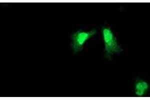 Image no. 2 for anti-ADP-Ribosylation Factor-Like 11 (ARL11) antibody (ABIN1496714) (ARL11 抗体)