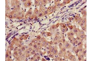 Immunohistochemistry of paraffin-embedded human liver tissue using ABIN7144667 at dilution of 1:100 (AADAC 抗体  (AA 24-399))
