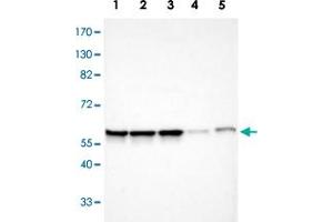 Western blot analysis of Lane 1: Human cell line RT-4; Lane 2: Human cell line U-251MG sp; Lane 3: Human cell line A-431; Lane 4: Human liver tissue; Lane 6: Human tonsil tissue with APEX1 polyclonal antibody  at 1:100-1:250 dilution. (APEX1 抗体)