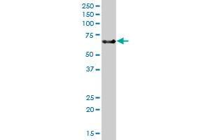 Western Blotting (WB) image for anti-Tumor Necrosis Factor Receptor Superfamily, Member 21 (TNFRSF21) (AA 1-655) antibody (ABIN525915)