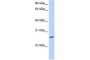 ZNF664 antibody used at 0. (ZNF664 抗体  (N-Term))
