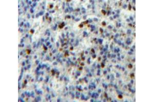 Used in DAB staining on fromalin fixed paraffin- embedded spleen tissue (ATG16L1 抗体  (AA 1-284))