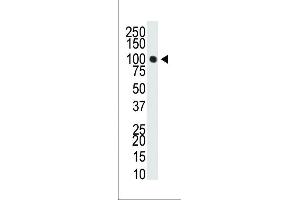 Western Blotting (WB) image for anti-DNA (Cytosine-5-)-Methyltransferase 3 alpha (DNMT3A) (AA 457-486) antibody (ABIN387881)