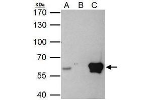 Immunoprecipitation (IP) image for anti-V-Ets Erythroblastosis Virus E26 Oncogene Homolog 2 (ETS2) (Center) antibody (ABIN2855845)