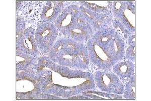 IHC analysis of NDEL1 using anti-NDEL1 antibody (ABIN7602511). (NDEL1 抗体  (AA 80-320))