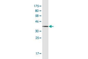 Western Blot detection against Immunogen (35. (THO Complex 4 抗体  (AA 106-193))