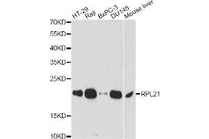 Western blot analysis of extracts of various cell lines, using RPL21 antibody. (RPL21 抗体)