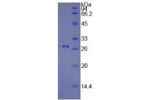 SDS-PAGE of Protein Standard from the Kit  (Highly purified E. (COL1A1 ELISA 试剂盒)