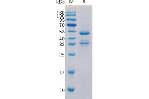 Human TACI Protein, hFc Tag on SDS-PAGE under reducing condition.