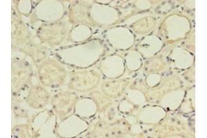 Immunohistochemistry (IHC) image for anti-G0/G1switch 2 (G0S2) (AA 1-103) antibody (ABIN6090663)