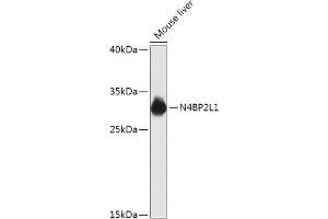 Western blot analysis of extracts of Mouse liver, using N4BP2L1 antibody (ABIN7268840) at 1:1000 dilution. (N4BP2L1 抗体  (AA 40-120))
