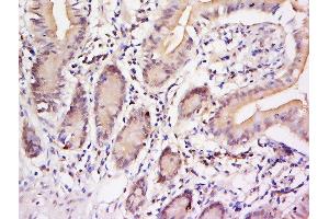 Immunohistochemistry (Paraffin-embedded Sections) (IHC (p)) image for anti-Signal Transducer and Activator of Transcription 3 (Acute-Phase Response Factor) (STAT3) (pTyr705) antibody (ABIN732638)