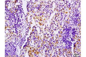 Formalin-fixed and paraffin embedded rat skin tissue tissue labeled with Anti PHOSPHO-MAP4K1(SER171) Polyclonal Antibody,Unconjugated (ABIN710396) at 1:200 followed by conjugation to the secondary antibody and DAB staining. (MAP4K1 抗体  (pSer171))
