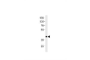 DANRE hoxd11a Antibody (Center) Azb10017a western blot analysis in zebra fish heart tissue lysates (35 μg/lane). (HOXD11 抗体  (AA 128-155))