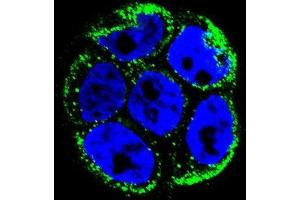 Confocal immunofluorescent analysis of VILL Antibody (Center) with WiDr cell followed by Alexa Fluor 488-conjugated goat anti-rabbit lgG (green). (VILL 抗体  (Middle Region))