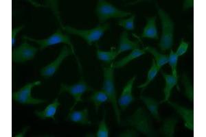 Immunofluorescent staining of HeLa cells using anti-UCK1 mouse monoclonal antibody (ABIN2453770). (UCK1 抗体)