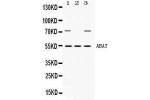 Western blot analysis of ABAT expression in rat brain extract ( Lane 1), mouse testis extract ( Lane 2) and HEPG2 whole cell lysates ( Lane 3). (ABAT 抗体  (AA 388-500))
