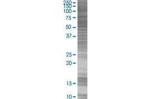 RARG transfected lysate.