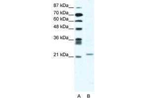 Western Blotting (WB) image for anti-Twist Homolog 1 (Drosophila) (TWIST1) antibody (ABIN2461623) (TWIST1 抗体)