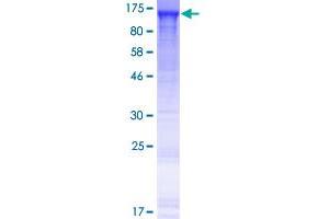 Image no. 1 for Enhancer Trap Locus 4 (ETL4) (AA 1-877) protein (GST tag) (ABIN1308607) (ETL4 Protein (AA 1-877) (GST tag))