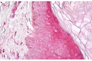 Anti-BMP7 antibody IHC staining of human skin, epidermis.