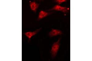 Immunofluorescence (fixed cells) (IF/ICC) image for anti-V-Akt Murine Thymoma Viral Oncogene Homolog 1 (AKT1) (pThr450) antibody (ABIN6256564)