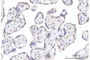 IHC analysis of RBM22 using anti-RBM22 antibody (ABIN7600268).