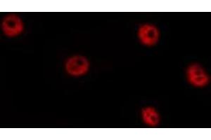 ABIN6277434 staining HepG2 by IF/ICC. (TCF7 抗体)